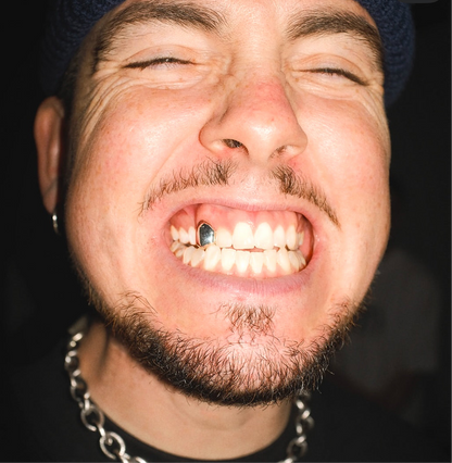 Single Cap Grillz